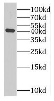 MAGEA10 Rabbit Polyclonal Antibody
