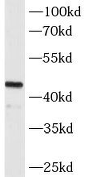 MAGEA3 Mouse Monoclonal Antibody