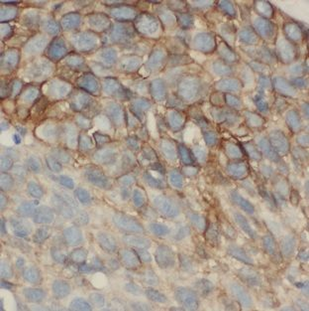 MAGEA3 Mouse Monoclonal Antibody