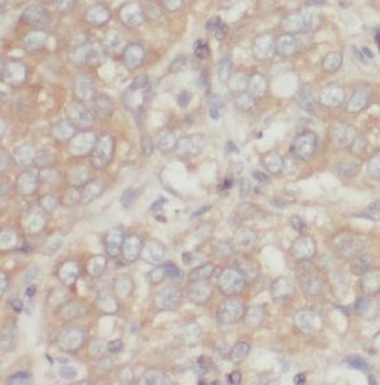 MAGEA4 Antibody
