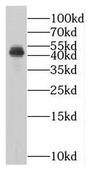 MAGEB1 Antibody