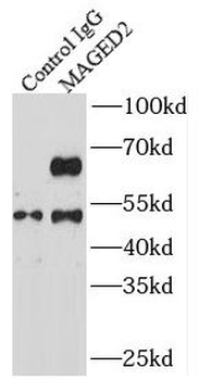 MAGED2 Antibody