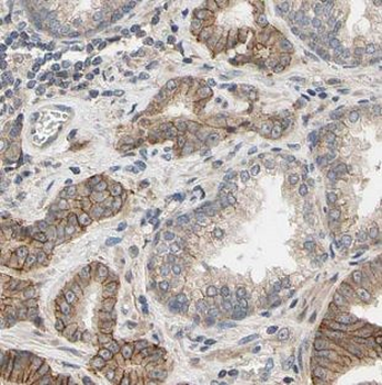 MAGEH1 Antibody