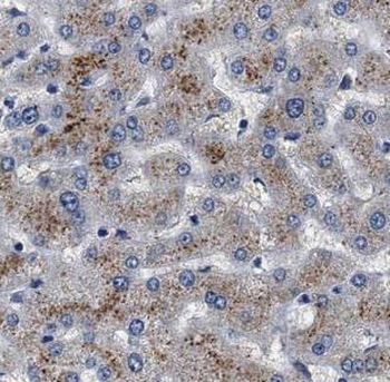 MAGT1 Antibody