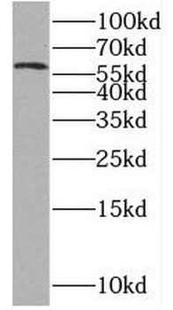 MAK Rabbit Polyclonal Antibody