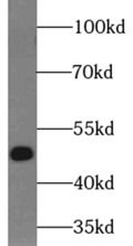 MAK16 Rabbit Polyclonal Antibody