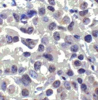 MALT1 Antibody