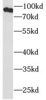 MALT1 Mouse Monoclonal Antibody
