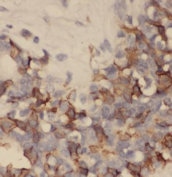 SCGB2A2 Antibody