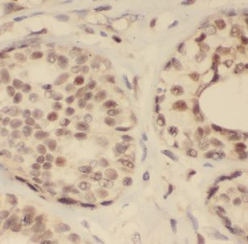 SCGB2A2 Mouse Monoclonal Antibody