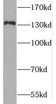 MAN2B2 Antibody