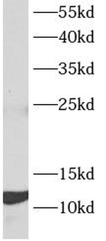 MANBAL Antibody