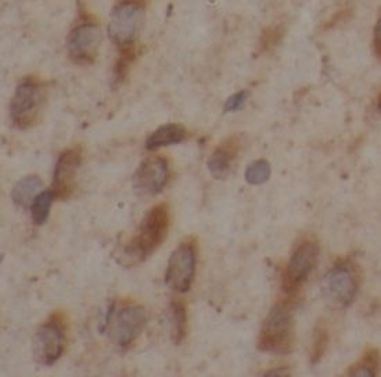 MANBAL Antibody