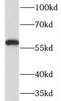 MAOB Rabbit Polyclonal Antibody