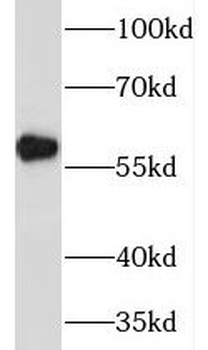 MAOB Rabbit Polyclonal Antibody