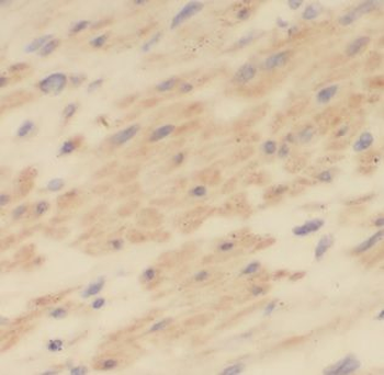 MAP1S Antibody