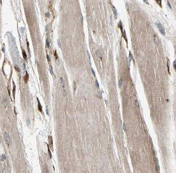 MAP4K4 Antibody