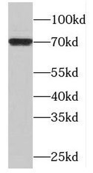 MAPK7 Rabbit Polyclonal Antibody