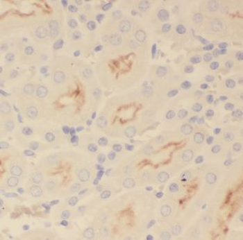 MAPKAP1 Antibody