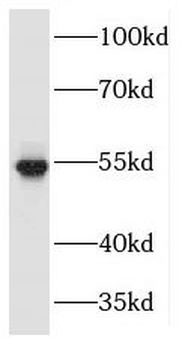 MAPKAPK5 Rabbit Polyclonal Antibody