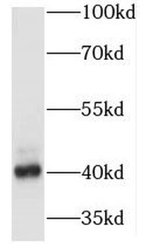 MAPRE2 Antibody