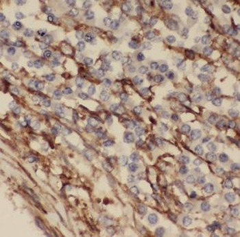 MARCKSL1 Antibody