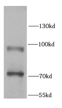 MARK1 Rabbit Polyclonal Antibody