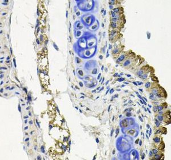 MARK1 Rabbit Polyclonal Antibody