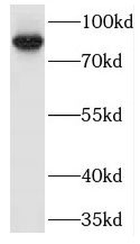 MARK3 Rabbit Polyclonal Antibody