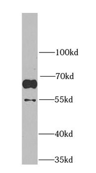 MARVELD2 Rabbit Polyclonal Antibody