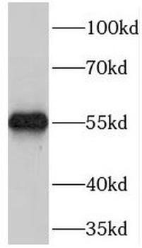 MASP1 Rabbit Polyclonal Antibody