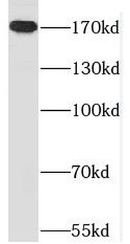 MAST1 Antibody