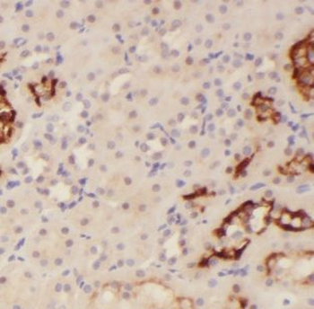 MAST3 Antibody