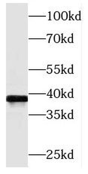 MAT2B Antibody