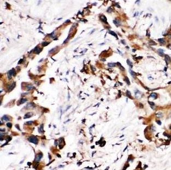 MAT2B Antibody