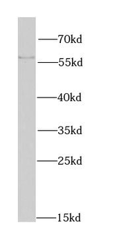 MATK Antibody