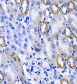 MATK Antibody