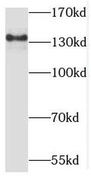 MATN2 Antibody