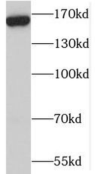 MBD5 Rabbit Polyclonal Antibody
