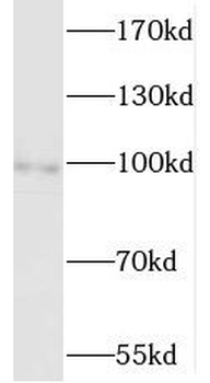 MCC Antibody