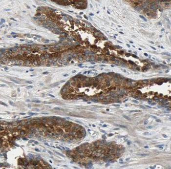 MCC Antibody