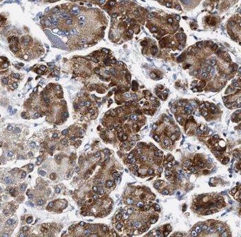 MCCC1 Antibody