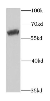 MCCC2 Antibody