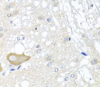 MCCC2 Antibody