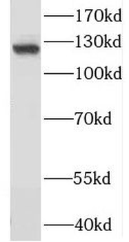 MCM2 Rabbit Polyclonal Antibody