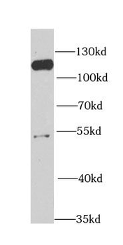 MCM6 Antibody