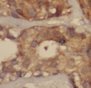 CCL2 Antibody