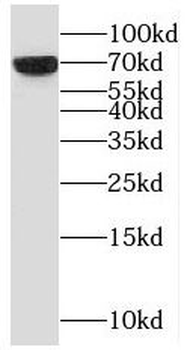 CSF1 Rabbit Polyclonal Antibody