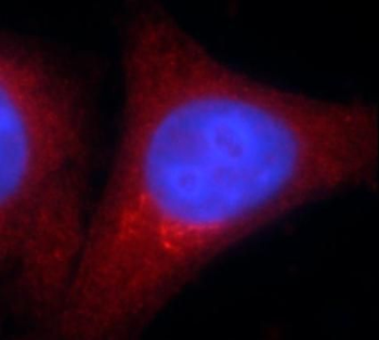 MDH1 Antibody