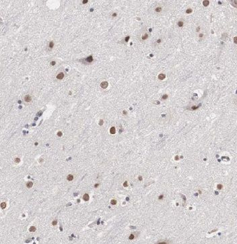 MDM1 Antibody